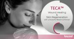 TECA